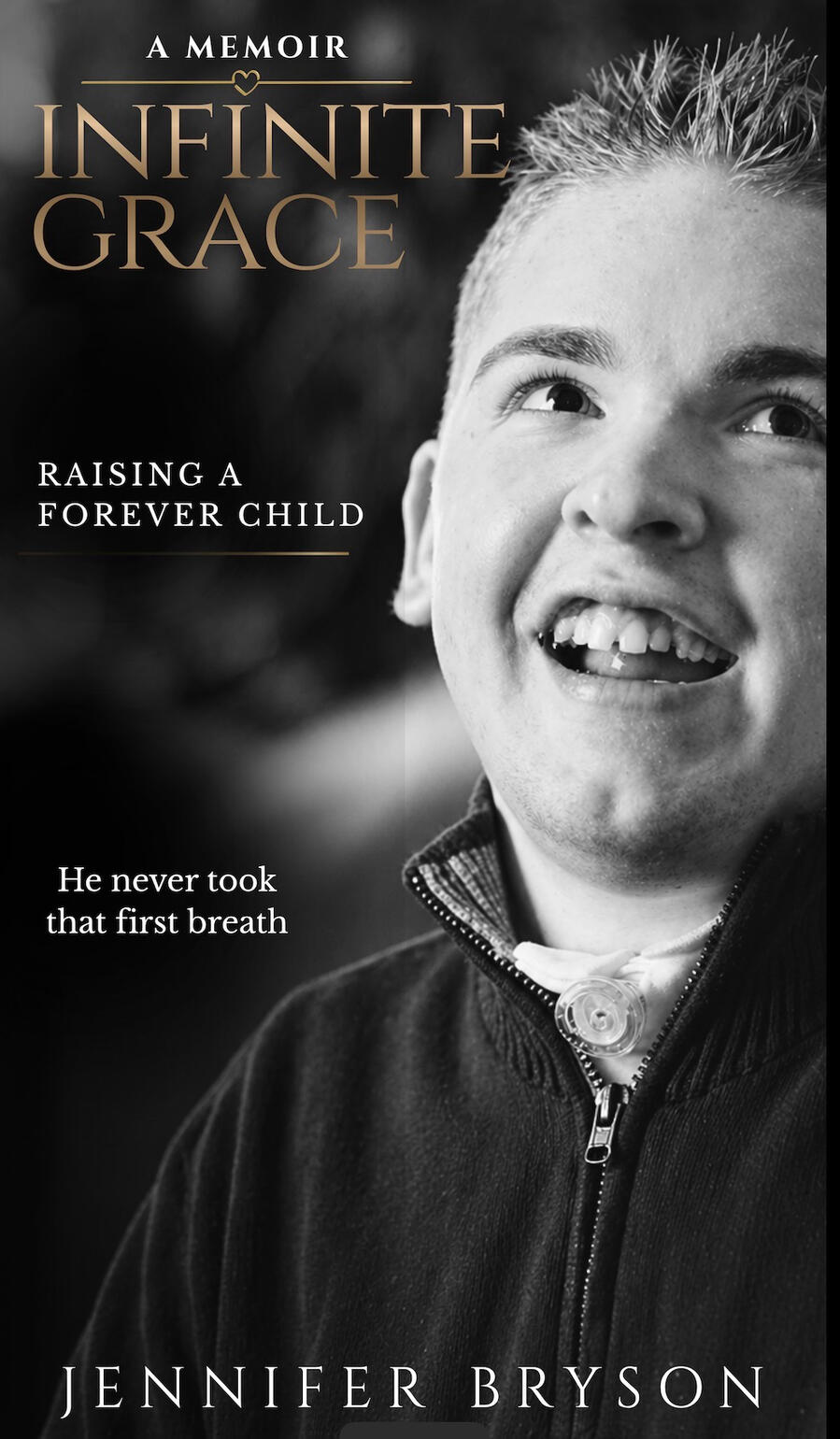 Infinite Grace Raising A Forever Child
